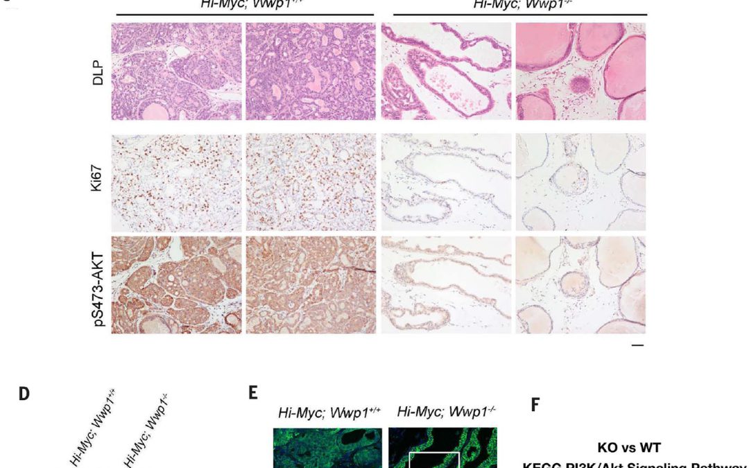 Reactivation of PTEN tumor suppressor for cancer treatment through inhibition of a MYC-WWP1 inhibitor pathway